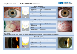 Image Exposure Guide  EyeSuite IM900 LED Illumination v1.1 Diffuse Illumination Magnification  10 x or 16 x  Slit Illumination Level Background Level  Open @ 45 degrees, Diffused 7 2  Aperture  5  EyeSuite Exposure  1/90 Preset 1  Diffuse - Conjunctiva Magnification  10x or 16x  Slit Illumination Level Background Level  Open @45 degrees, Diffused, 4 1  Aperture  6  EyeSuite Exposure  1/125 Preset 1  Tips & Technique *Low magnification – overview images *Open slit fully – slit width can also be used to control exposure * Beware of unwanted reflection artefacts  Narrow Slit – Cornea Magnification  16x or 25x  Slit Illumination Level Background Level  < 0.2mm wide >60 degrees from mic 10 1  Aperture  1  EyeSuite Exposure  1/30 Preset 1  