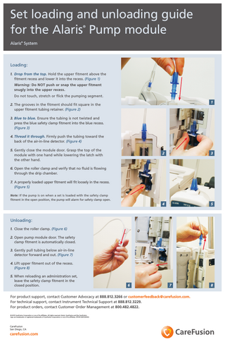 Set loading and unloading guide for the Alaris Pump module ®  Alaris System ®  Loading: 1. Drop from the top. Hold the upper fitment above the fitment recess and lower it into the recess. (Figure 1) Warning: Do NOT push or snap the upper fitment snugly into the upper recess. Do not touch, stretch or flick the pumping segment.  1  2. The grooves in the fitment should fit square in the upper fitment tubing retainer. (Figure 2) 3. Blue to blue. Ensure the tubing is not twisted and press the blue safety clamp fitment into the blue recess. (Figure 3) 4. Thread it through. Firmly push the tubing toward the back of the air-in-line detector. (Figure 4) 5. Gently close the module door. Grasp the top of the module with one hand while lowering the latch with the other hand.  2  3  4  5  6. Open the roller clamp and verify that no fluid is flowing through the drip chamber. 7. A properly loaded upper fitment will fit loosely in the recess. (Figure 5) Note: If the pump is on when a set is loaded with the safety clamp fitment in the open position, the pump will alarm for safety clamp open.  Unloading: 1. Close the roller clamp. (Figure 6) 2. Open pump module door. The safety clamp fitment is automatically closed. 3. Gently pull tubing below air-in-line detector forward and out. (Figure 7) 4. Lift upper fitment out of the recess. (Figure 8) 5. When reloading an administration set, leave the safety clamp fitment in the closed position.  6  7  For product support, contact Customer Advocacy at 888.812.3266 or customerfeedback@carefusion.com. For technical support, contact Instrument Technical Support at 888.812.3229. For product orders, contact Customer Order Management at 800.482.4822. © 2015 CareFusion Corporation or one of its affiliates. All rights reserved. Alaris, CareFusion and the CareFusion logo are trademarks or registered trademarks of CareFusion Corporation or one of its affiliates. IF5135 (0815/2500)  CareFusion San Diego, CA  carefusion.com  8  