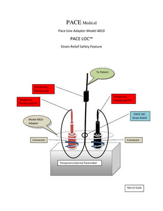 PACE Medical Pace Line Adapter Model 4810  PACE LOC™ Strain Relief Safety Feature  To Patient  Temporary Pacing Lead Temporary Pacing Lead Pin  Temporary Pacing Lead Pin  PACE LOC Strain Relief  Model 4810 Adapter  Connector  Connector  Temporary External Pacemaker  Not to Scale  