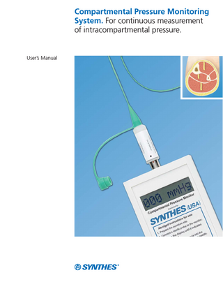 Table of Contents  Introduction  Instructions  Product Information  Compartmental Pressure Monitoring System  2  Indications  4  Operating Instructions  5  Care and Maintenance  8  Sterilization  11  System Messages and Troubleshooting  12  Checking the Number of Remaining Measurements  13  Changing the Battery  14  Set List  15  Synthes  