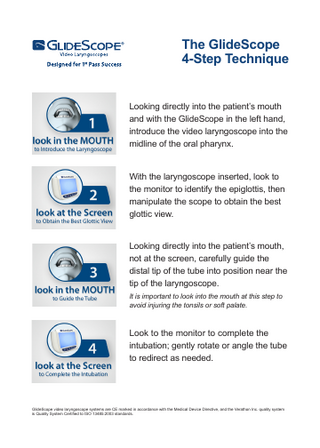 GlideScope 4 Step Technique Insertion Tips