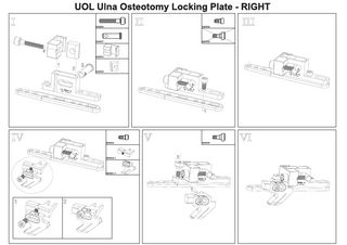 UOL Ulna Osteotomy Locking Plate - Assembly - Disassembly Guide 