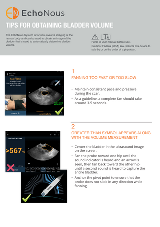 TIPS FOR OBTAINING BLADDER VOLUME The EchoNous System is for non-invasive imaging of the human body and can be used to obtain an image of the bladder that is used to automatically determine bladder volume.  Refer to user manual before use. Caution: Federal (USA) law restricts this device to sale by or on the order of a physician.  1  FANNING TOO FAST OR TOO SLOW • Maintain consistent pace and pressure during the scan. • As a guideline, a complete fan should take around 3-5 seconds.  2  GREATER THAN SYMBOL APPEARS ALONG WITH THE VOLUME MEASUREMENT • Center the bladder in the ultrasound image on the screen. • Fan the probe toward one hip until the sound indicator is heard and an arrow is seen, then fan back toward the other hip until a second sound is heard to capture the entire bladder. • Anchor the pivot point to ensure that the probe does not slide in any direction while fanning.  