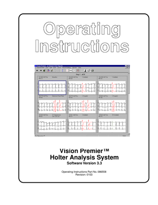 Vision Premier Holter Analysis System Operating Instructions Rev 0103 Sw Ver 3.3