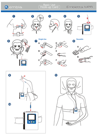Basic Unit  Hook-up Card 2  1  Embletta MPR 4  3  5  SpO2  SND  embla  ExG  SpO2  SND  PFlow  ExG  embla  PGND REF  PGND  NAF THO  -  Embletta MPR  +  ABD DC  REF NAF THO ABD DC  2OpS  DNS  D D C C  A A B B D D  T T H H O O  N N A A F F  R R E E F F  P P G G N N D D  E E x x G G  wolFP  7  6  Single Use  A  D  Reusable  8  A B  E B  SpO2  SND  C  PFlow  ExG  embla  F  PGND REF NAF THO  -  Embletta MPR  +  ABD DC  11  9  SpO2  SND  PFlow  ExG  embla  PGND REF NAF THO  -  +  Embletta MPR  ABD DC  10 SpO2  SND  ExG  embla  PGND REF NAF THO ABD DC  SpO2  SND  ExG  embla  PGND REF NAF THO  -  +  Embletta MPR  PFlow  -  +  Embletta MPR  PFlow  -  +  Embletta MPR  PFlow  ABD DC  