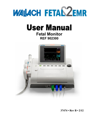 Table of Contents Chapter 1 Safety Guide ... 1 1.1 Intended Use... 1 1.2 Instruction for Safe Operation... 1 1.3 Ultrasound Safety Guide ... 2 1.4 Safety Precautions ... 2 1.5 Definitions and Symbols ... 6 Chapter 2 Monitor and Accessories ... 8 2.1 Opening and Checking Package... 8 2.2 Overview ... 9 2.2.1 Keys and Control Knob... 11 2.2.2 Indicators ... 13 2.3 Accessories ... 14 2.3.1 Ultrasound (US) Transducer ... 14 2.3.2 TOCO Transducer ... 14 2.3.3 Belt ... 14 2.3.4 Remote Event Marker ... 15 2.4 Screen ... 15 2.4.1 Main Interface ... 15 2.4.2 Setup Interface ... 17 Chapter 3 Installation Guide... 18 3.1 Installing Battery ... 18 3.2 Installing Monitor ... 20 3.3 Loading Recorder paper ... 20 3.4 Tearing Off Recorder paper ... 23 3.5 Adjusting Screen Angle ... 23 3.6 Connecting Transducers ... 24 3.7 Placing Accessories in the Holder... 24 3.8 Connecting Power Cable ... 25 Chapter 4 Alarms ... 26 4.1 Alarms Classification ... 26 4.2 Audible Alarm... 26 4.3 Visual Alarm ... 26 4.4 Choosing Alarm Silence Duration ... 27 4.5 Choosing Alarm Display Form ... 27 4.6 Changing Alarm Volume ... 28 4.7 Reviewing Alarms ... 28 4.8 Alarm Treatment Measures ... 28 4.9 Testing Alarms ... 28 4.10 Patient Alarm Defaults ... 29 Chapter 5 Printing ... 30 5.1 Function Description ... 30 5.2 Printing Configuration ... 30 5.2.1 Switching Auto Start Printing On or Off ... 31 - II -  