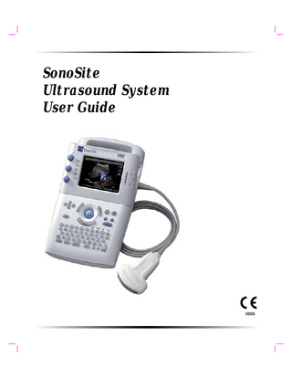 SonoSite 180 User Guide P02614-03A