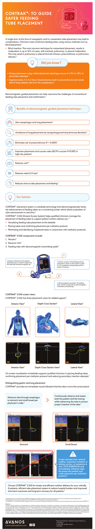 CORTRAK : To Guide safer Feeding Tube Placement Guide